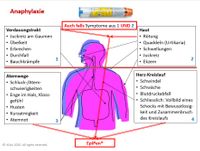 Anaphylaxie: Autoinjektorgabe